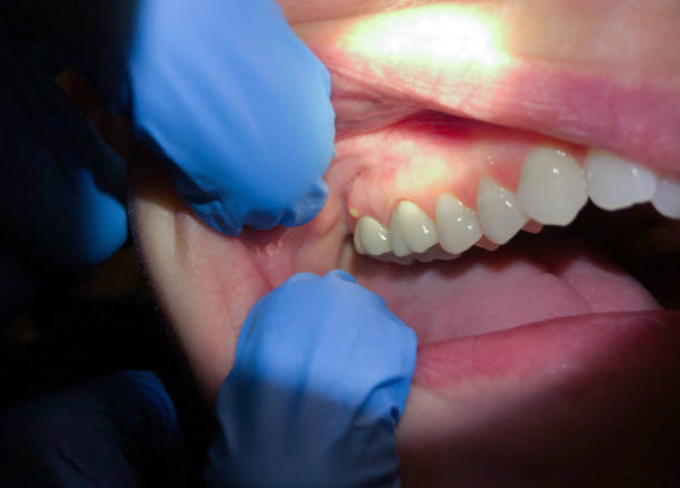 Best Emergency Treatment for Toothache in Crystal Lake, IL