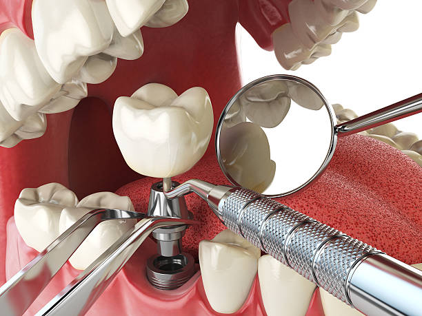 Best Emergency Dental Care for Trauma or Injury in Crystal Lake, IL