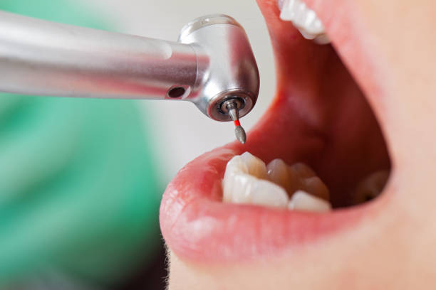 Best Emergency Treatment for Toothache in Crystal Lake, IL